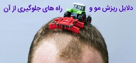 دلایل ریزش مو و راه های جلوگیری از آن دلایل ریزش مو و راه های جلوگیری از آن